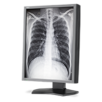 NEC DISPLAY ANNOUNCES LED-BACKLIT 3 MEGAPIXEL  MD212G3 DIAGNOSTIC MONITOR